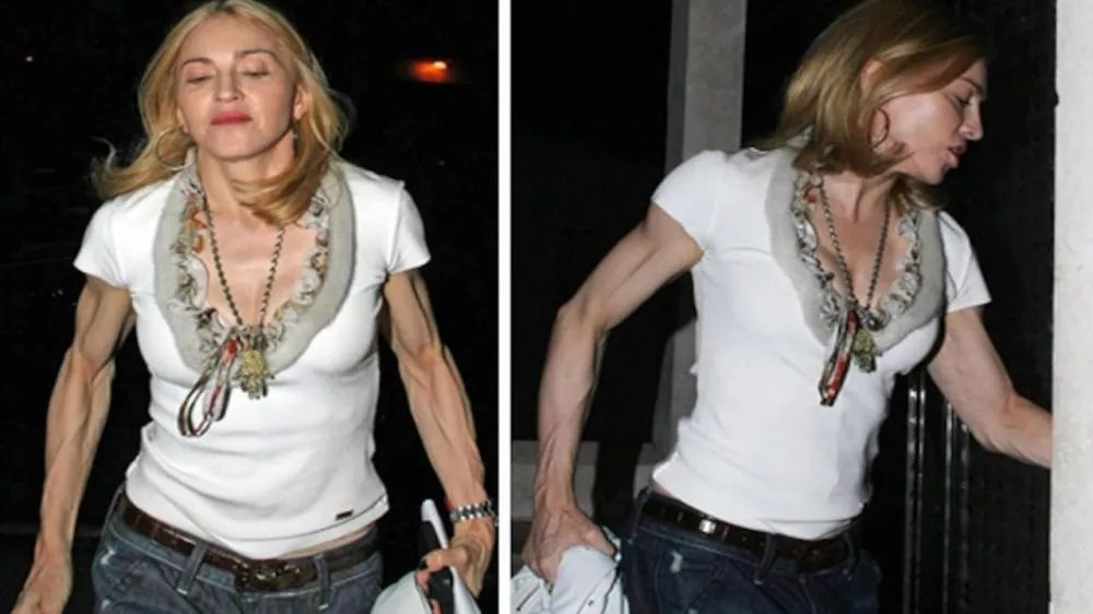 Madonnos sveikatos krizė