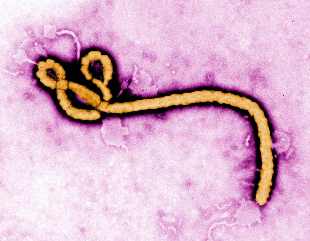 Ebolos virusas
