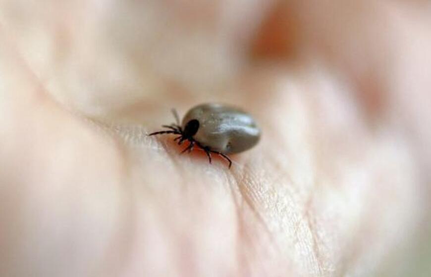 Ką būtina žinoti apie erkes: traukdami nedarykite šių klaidų