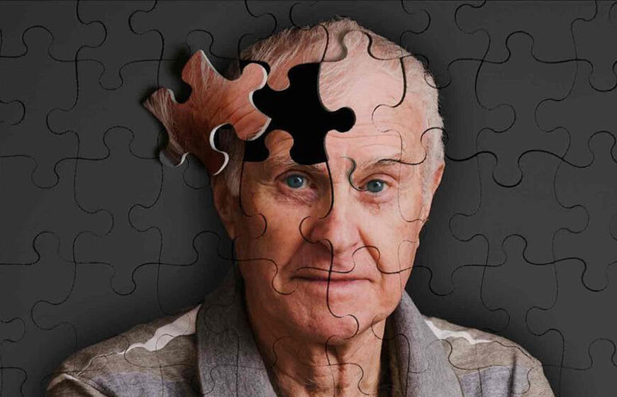 Neakivaizdūs demencijos simptomai, kurių negalima ignoruoti