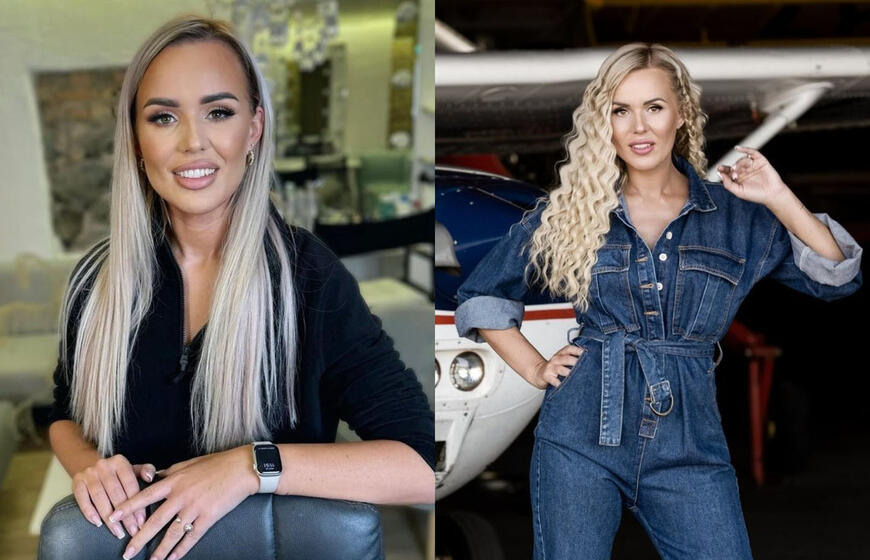 Donatai Gutauskienei-Laisvai per filmavimą užsidegė plaukai