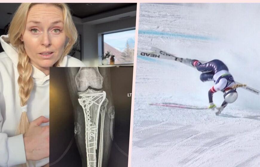 Lindsey Vonn sveiksta po siaubingo kritimo Milano-Kortinos žaidynėse