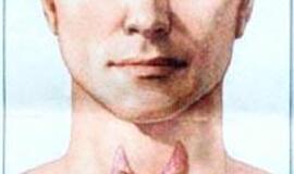 Reta, bet klastinga liga