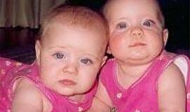 Ko pamirštame paklausti vaikų gydytojo