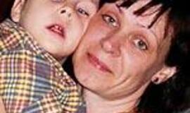 Lukui, sergančiam reta genetine liga, reikalinga pagalba