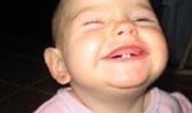 Pusmetis eilėje pas ortodontą - normalu