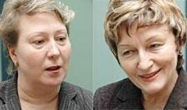 Agresyvių ligonių slauga - be prievartos ir diržų