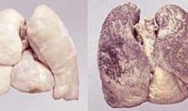 Kova su rūkymu: reikia naujų ginklų