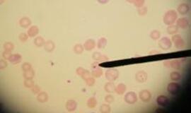 Kazachstane nuo juodligės mirė 38 metų vyras