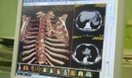 "Sveikatobusas" išrieda į Klaipėdos gatves