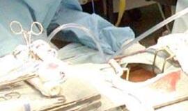 Moteriai operaciją atliko vienuolikametis