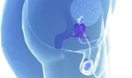 Tarptautiniame urologų kongrese – nauji prostatos vėžio gydymo būdai