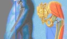 Ligoniai skundžiasi ilgomis endoprotezavimo laukiančiųjų eilėmis