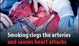 Britanijoje ant cigarečių pakelių bus šokiruojančios nuotraukos