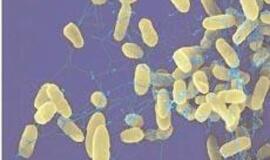 Inspektoriai tiria darželinukų apsinuodijimo maistu priežastis