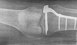 Pasaulinės osteoporozės dienos proga – dovana pacientams