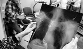 Lapkričio 19-oji – Pasaulinė lėtinės obstrukcinės plaučių ligos diena