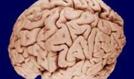 Insulto pažeistas smegenis "atstatinės“ kamieninės ląstelės