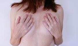 Genetiniai tyrimai gali padėti išvengti užprogramuoto krūties ir kiaušidžių vėžio