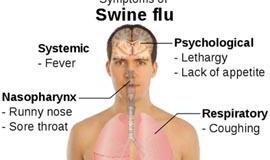 Britai patys sau diagnozuoja kiaulių gripą ir nesirodo darbe