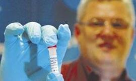 Naujojo gripo diagnozę Lietuvoje išgirdo dar šeši gyventojai