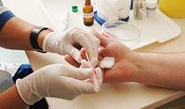 Tyrimų kainų skirtumas - kokybės rodiklis?