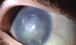 Pacientai ir medikai susibūrė į draugiją