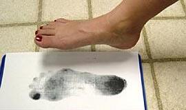 Plokščiapėdžiams - nauja gydymo metodika