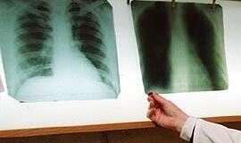 Liga, nesirenkanti aukų