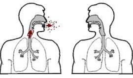Mokslininkai: dėl recesijos Baltijos šalyse gali padaugėti tuberkuliozės atvejų