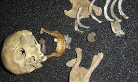Klaipėdoje rasti žmogaus kaulai ir kaukolė