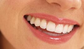 10 patarimų, kaip dantis išsaugoti sveikus
