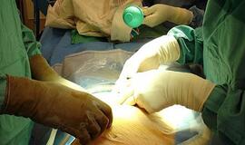 Nesutarę dėl cezario pjūvio Italijos operacinėje susipliekė du gydytojai