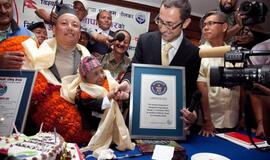 Mažiausias pasaulio žmogus - 65,5 cm ūgio nepalietis