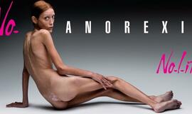 Mirė fotomodelis Isabelle Karo, išgarsėjusi šokiruojančia reklama prieš anoreksiją