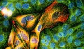 Atrasti nauji veiksmingesni vaistai nuo odos vėžio