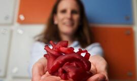3D spausdintuvas chirurgams atskleidžia neįprastų širdžių paslaptis