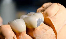 Vokietijos teismas atėmė licenciją iš stomatologo, kuris be priežasties pacientui išrovė beveik visus dantis