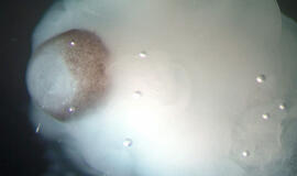 Laboratorinėmis sąlygomis užaugintos &quot;žmogaus smegenys&quot;