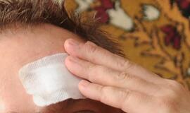 Smogė per galvą ir pagrobė piniginę su 2000 Lt