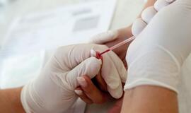 Kraujo donorui pirmą kartą nukleino rūgščių metodu nustatyta ŽIV infekcija