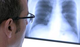 Radiologai: kada paskutinį kartą jums buvo atlikta krūtinės ląstos rentgenograma?