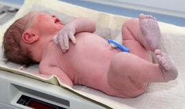 Vengrijoje gimė kūdikis, kurio motinai konstatuota smegenų mirtis