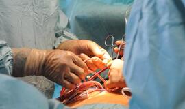 Vyras su širdimi pilve: 24-erių metų Kinų kirpėjui reikalinga operacija retos ydos pašalinimui