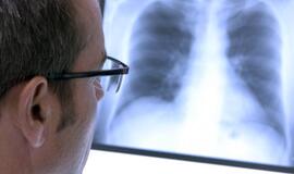 Ar prasidės Lietuvoje priverstinio tuberkuliozės gydymo era?