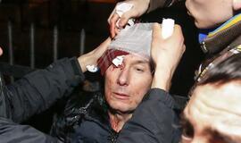 Po susirėmimų Kijeve opozicijos lyderis Jurijus Lucenka atsidūrė reanimacijoje