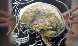 Mokslininkai atrado būdą, kaip "išjungti" smegenis