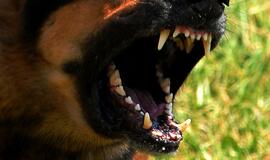 Teismo medicinos ekspertų tyrimai: nuo šunų įkandimų iki konfliktų traumų