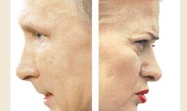 Įstrigo rusų ašaka