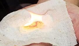 Gintaro ugnis panaudojama sveikatai